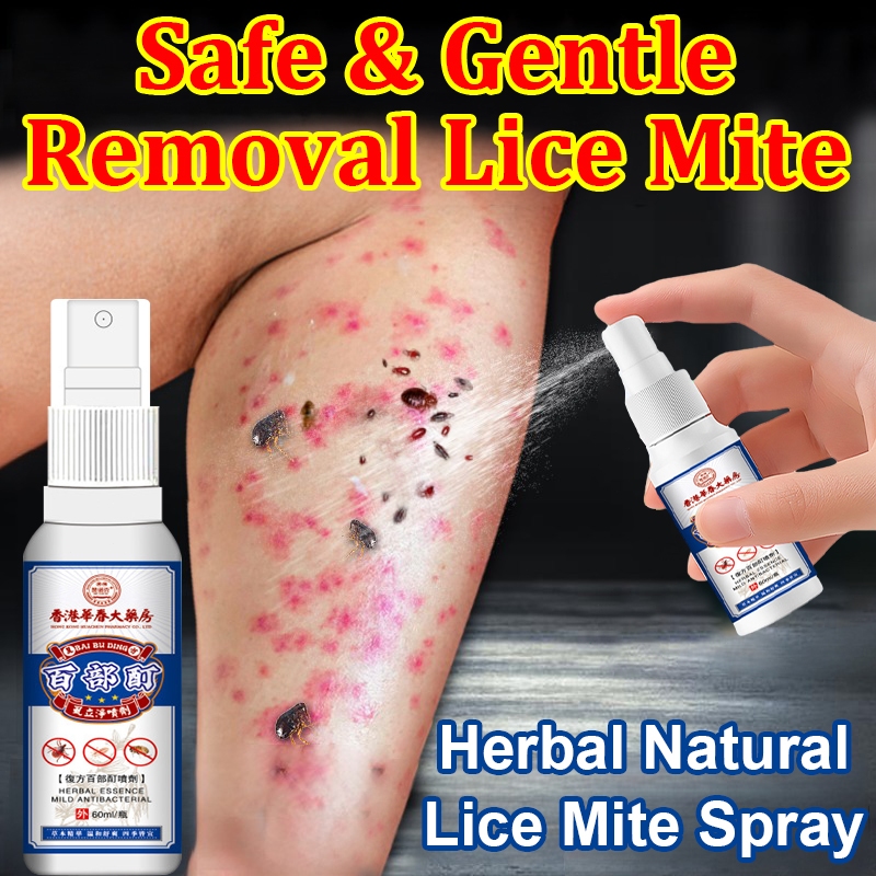 Hong Kong Lice Mite Spray 60ml Lice Mite Remover Remove body lice pubic ...