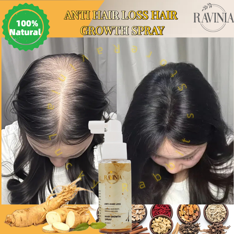 RAVINIA Hair growth spray 60ml Anti hair loss Natural plant essence ...