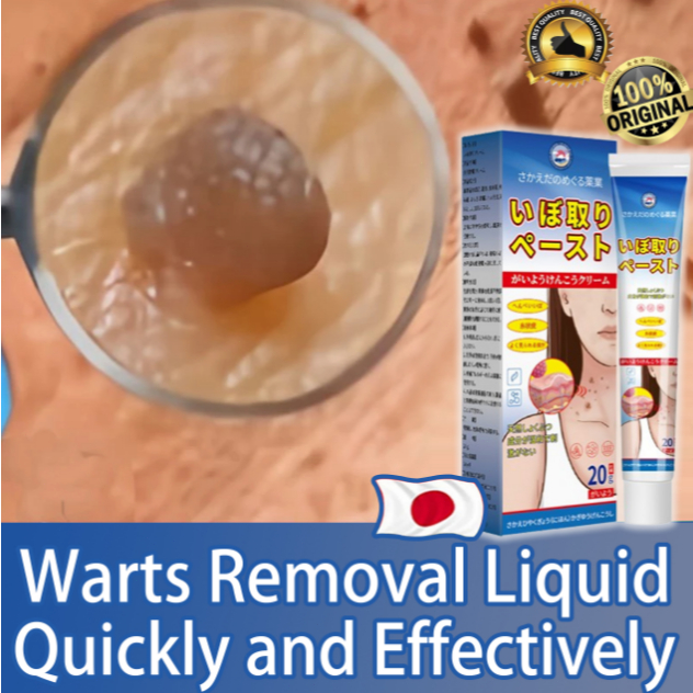 【100% original】Relieves the growth of flat warts, filiform warts ...