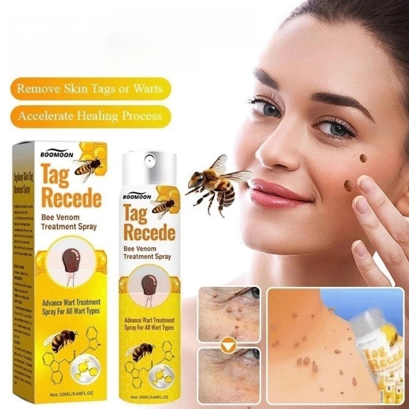 Bee Venom Spray Tag Recede Wart Remover Skin Tag Remover Ubat Ketuat ...