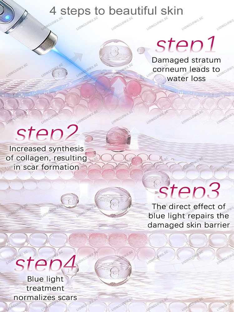 Product image ⚡️ Laser scar removal pen | Lightens acne/keloid/surgical scars | Painless and portable ✨ 5