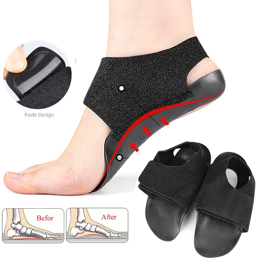 Wearable Orthopedic Insoles XO-Legs Orthotics Flat Foot Health Sole Pad ...