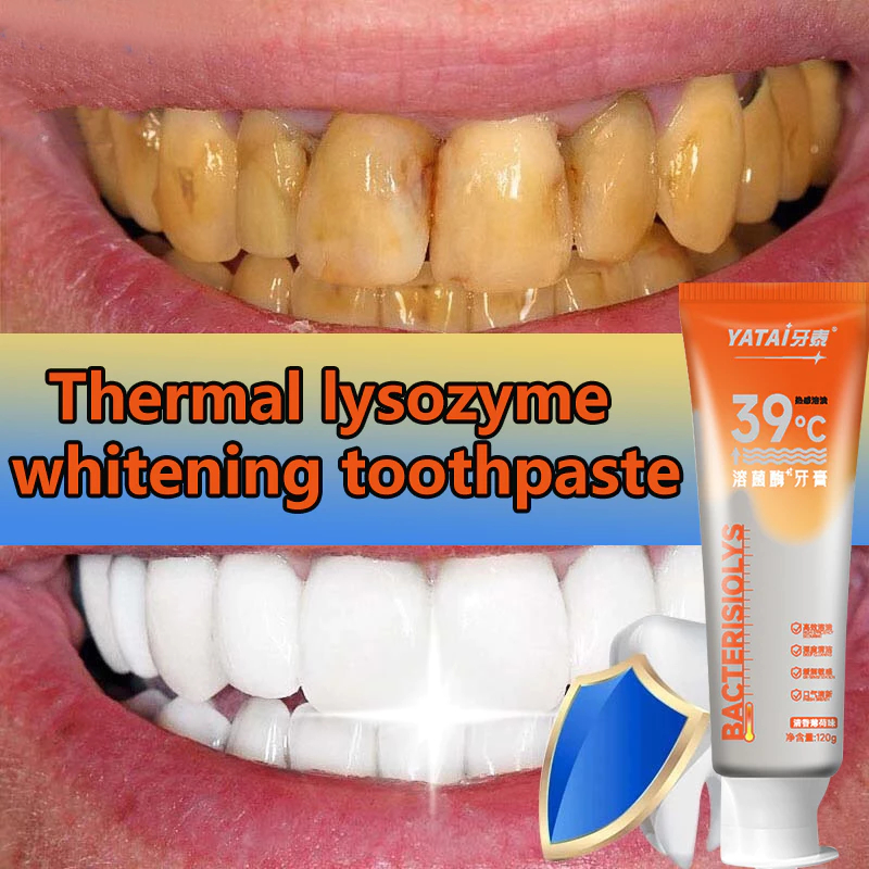 Antibacterial Enzyme Toothpaste Lysozyme Toothpaste 120g Removing ...