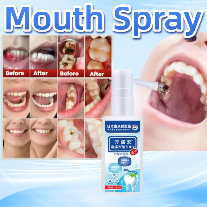 【SG Stock】Toothache Spray Antibacterial Mouth Spray Fresh Breath Spray ...