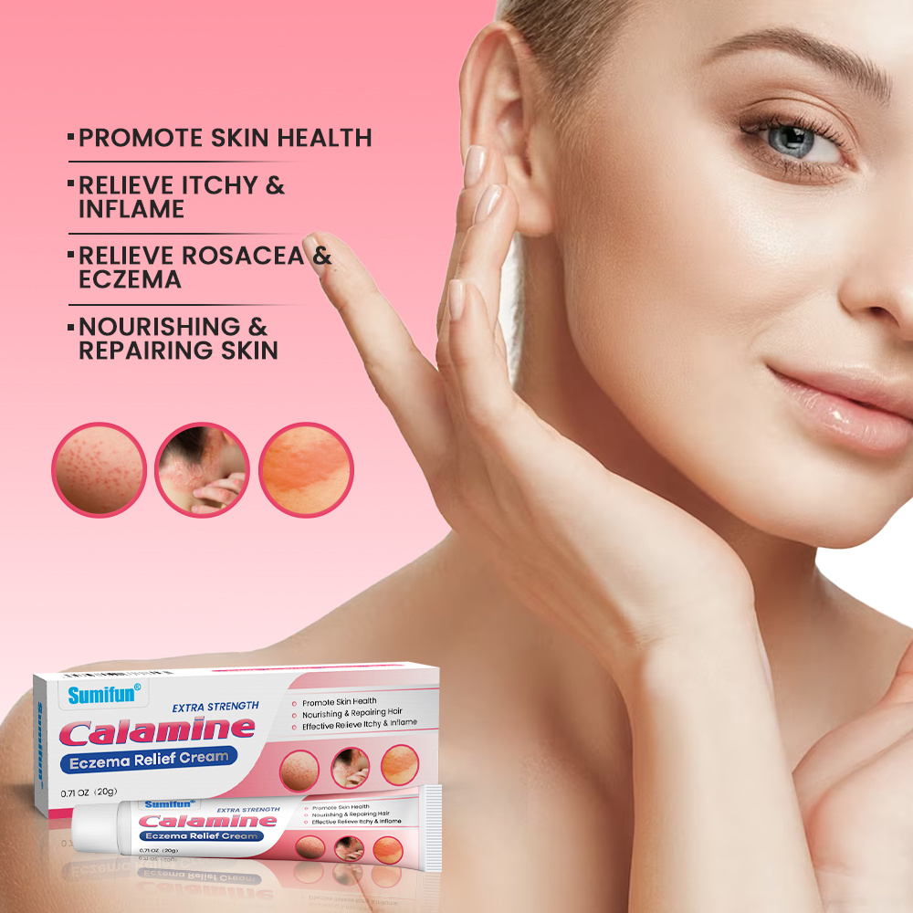 20g Extra Strength Calamine Eczema Relief Cream For Foot/Hand/Body All ...