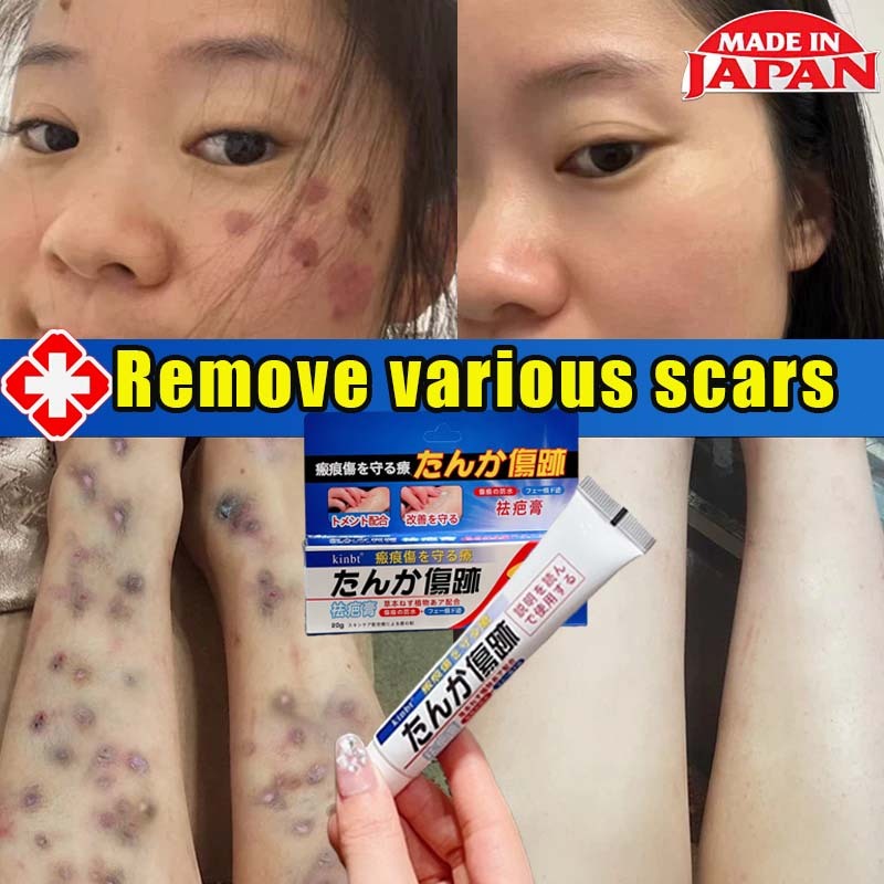 [Japan]Scar Removal Cream 20g lightens scars, removal Mosquito bite ...
