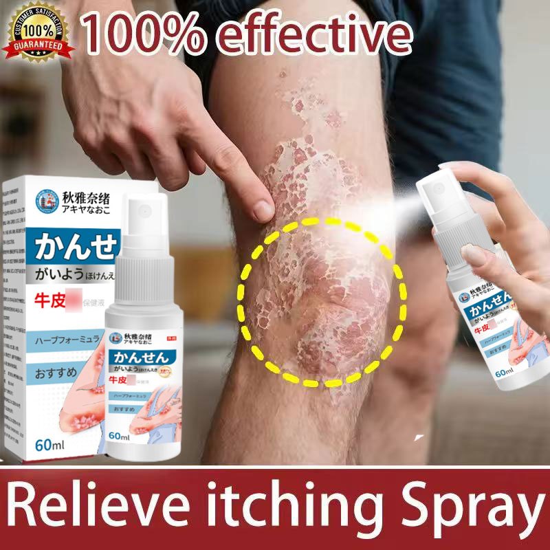 Psoriasis Relief Spray 60ml Eczema anti itch Spray psoriasis remission ...