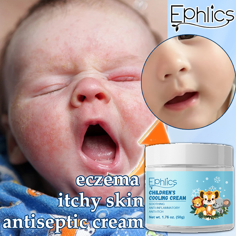 Ephlics Eczema Cream Itchy Skin Cream 50g Antiseptic Cream For Children ...