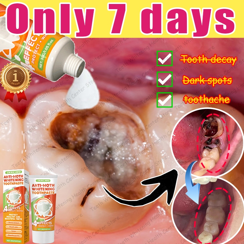 Anti-caries toothpaste, teeth repair toothpaste Tooth Decay Repair deep ...