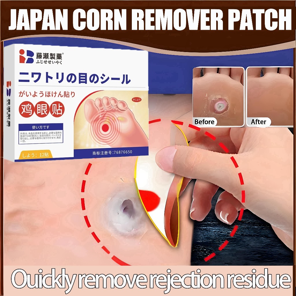 Japan Wart Removal Patch Corn Plaster 12pcs foot corn remover Corn Caps ...