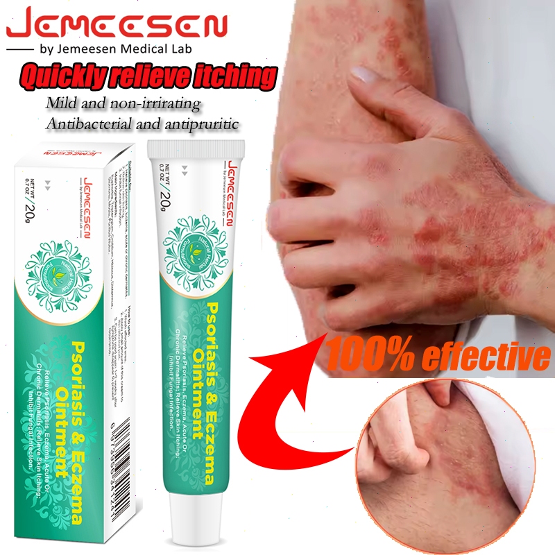 Jemeesen Psoriasis Eczema Cream Powerful Itch Relief Inflammation ...