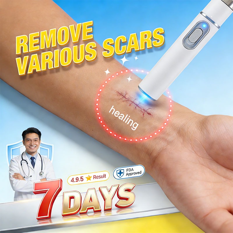 Clinically Proven & HSA Compliant Scars Laser Pen - Painless Removal ...