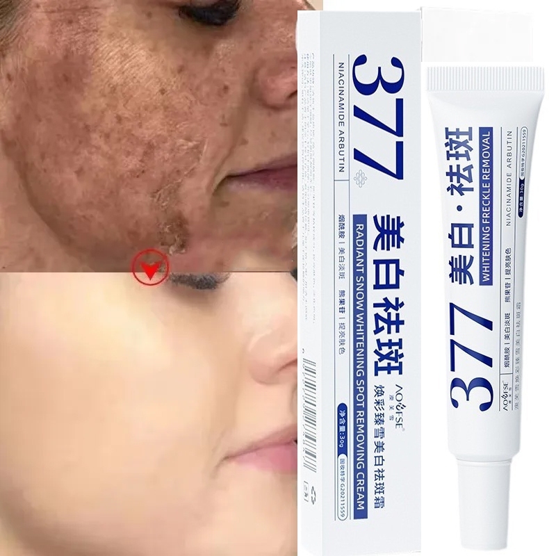 glutathione to lighten freckles 377 Whitening Face Cream Remove Dark Spots Melasma Melanin Acne Scars Anti-aging Brighten Skin Care Cosmetics travel vlog from North