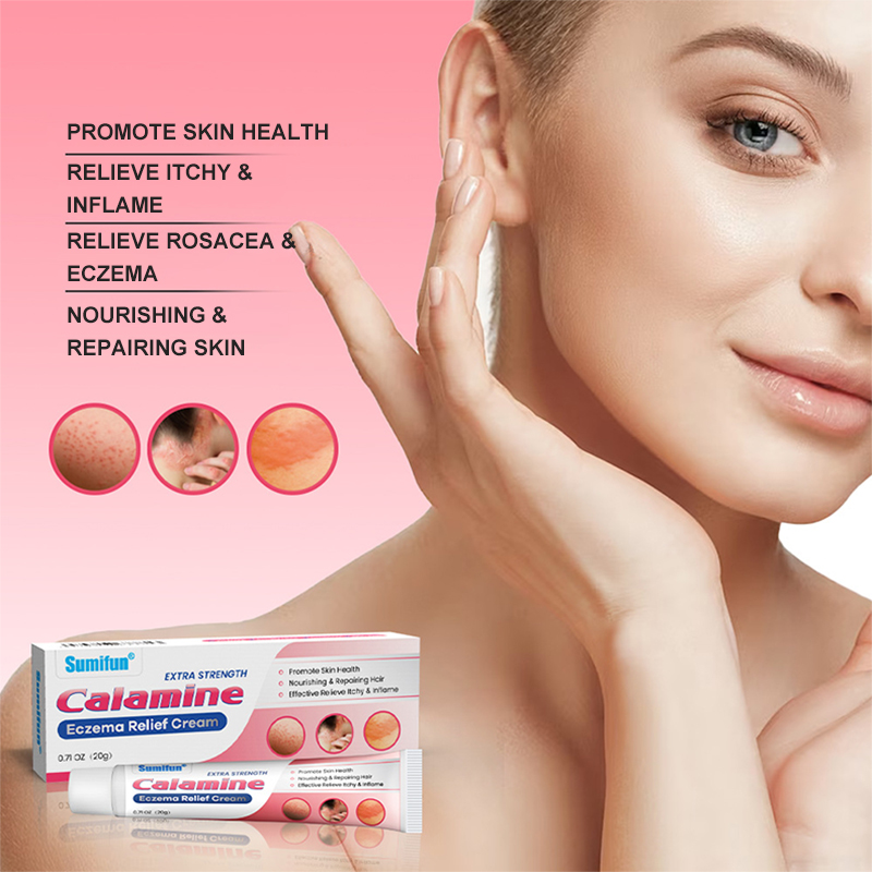 Calamine eczema cream 20g is suitable for skin itching, allergies ...