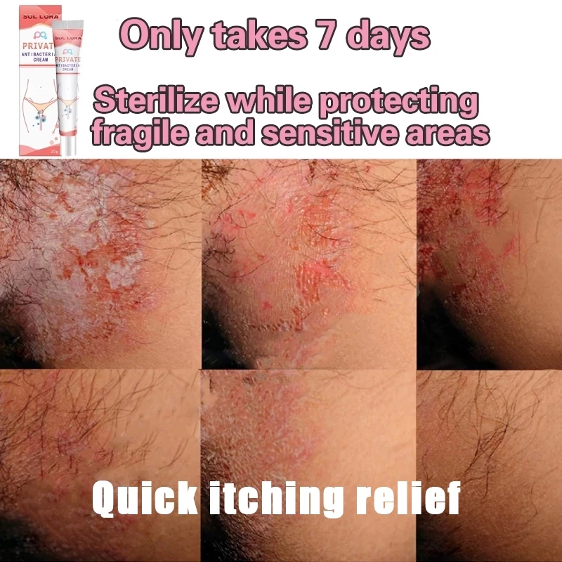Men's private parts anti itching Cream 20g antibacterial deodorize ...