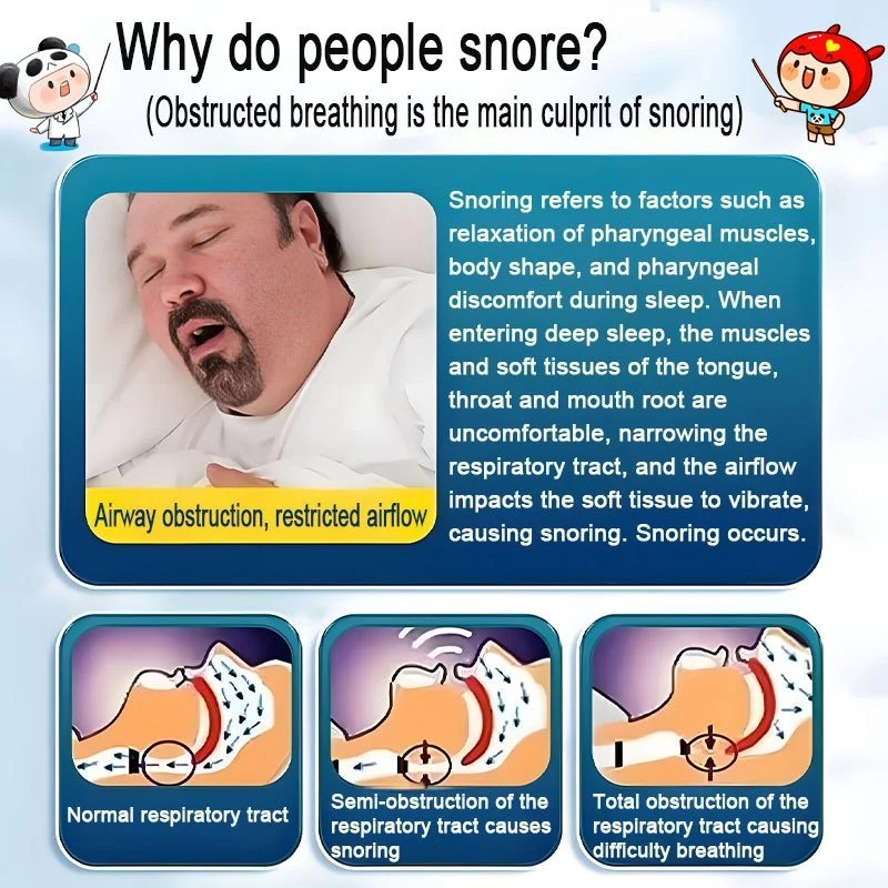 Anti-snoring rhinitis patch - relieve snoring, nasal congestion ...