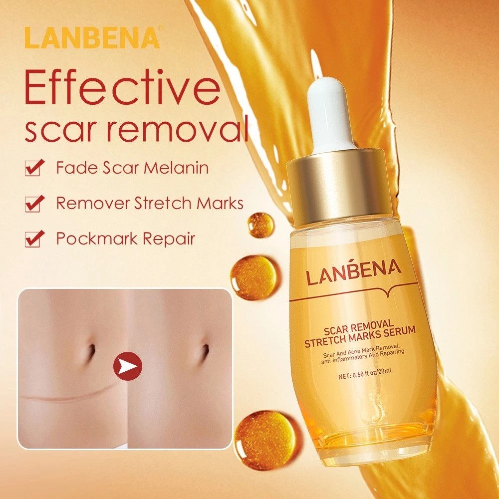 LANBENA Tcm Scar And Acne Mark Removal Gel Ointment/Scar Removal ...