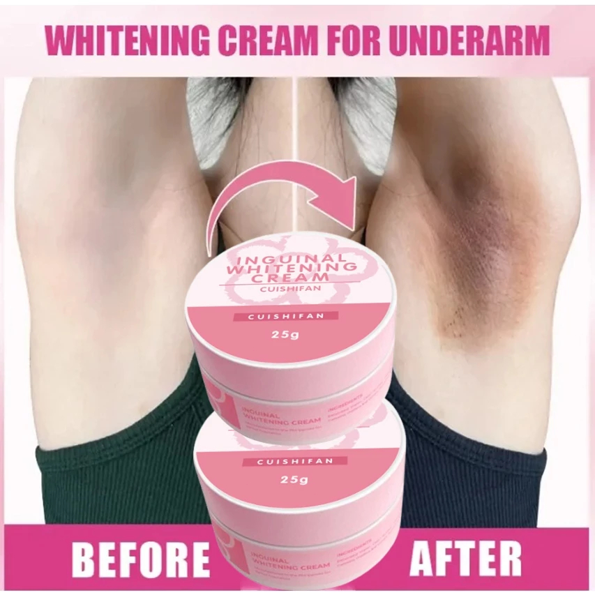 3pcs Whiten Armpits and Thigh Crevices Whitening Miss V Whitening Cream ...