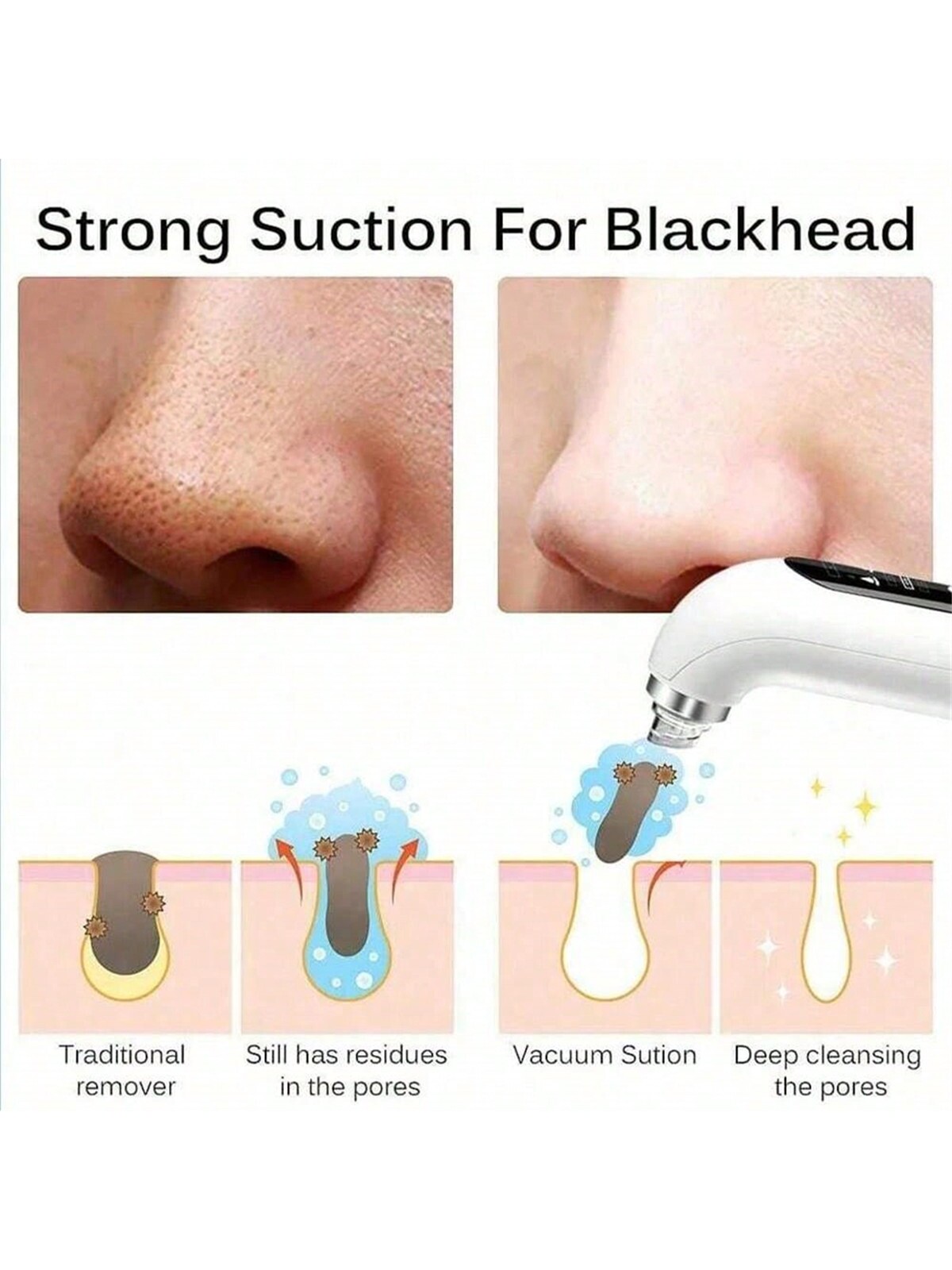 Advanced pore cleanser with 6 suction attachments. Handheld vacuum ...