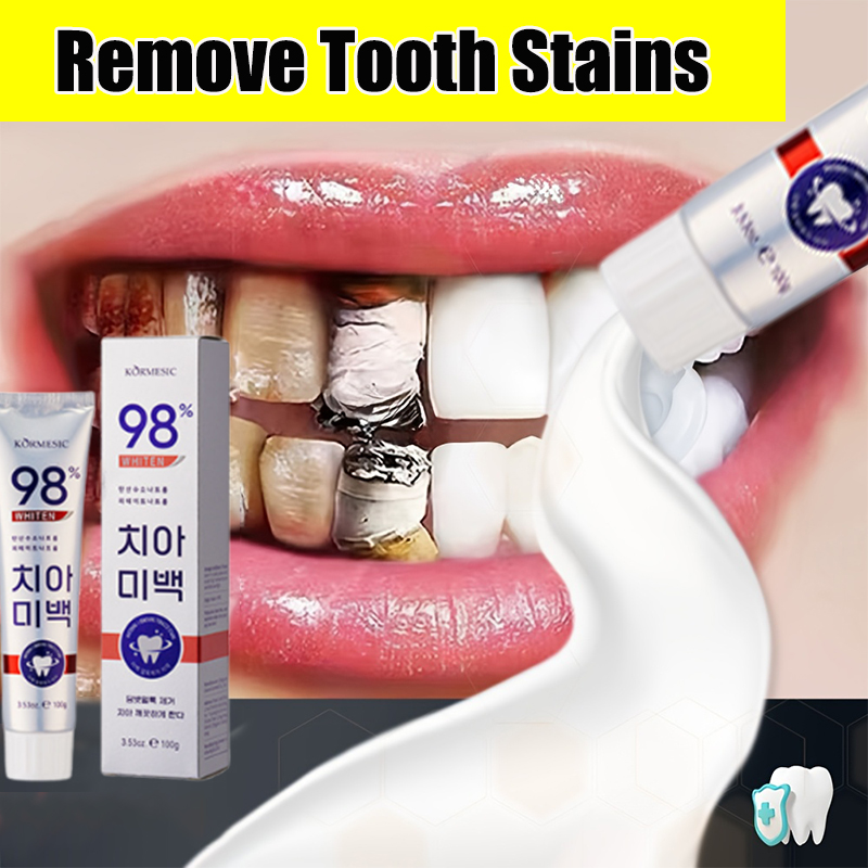 KORMESIC Whitening Toothpaste 100g Smokers Toothpaste Removal Tartar ...