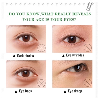 💯Perfect Removal💯Anti Wrinkle Eye Cream * Remove Eye Bags * Dark Eye ...