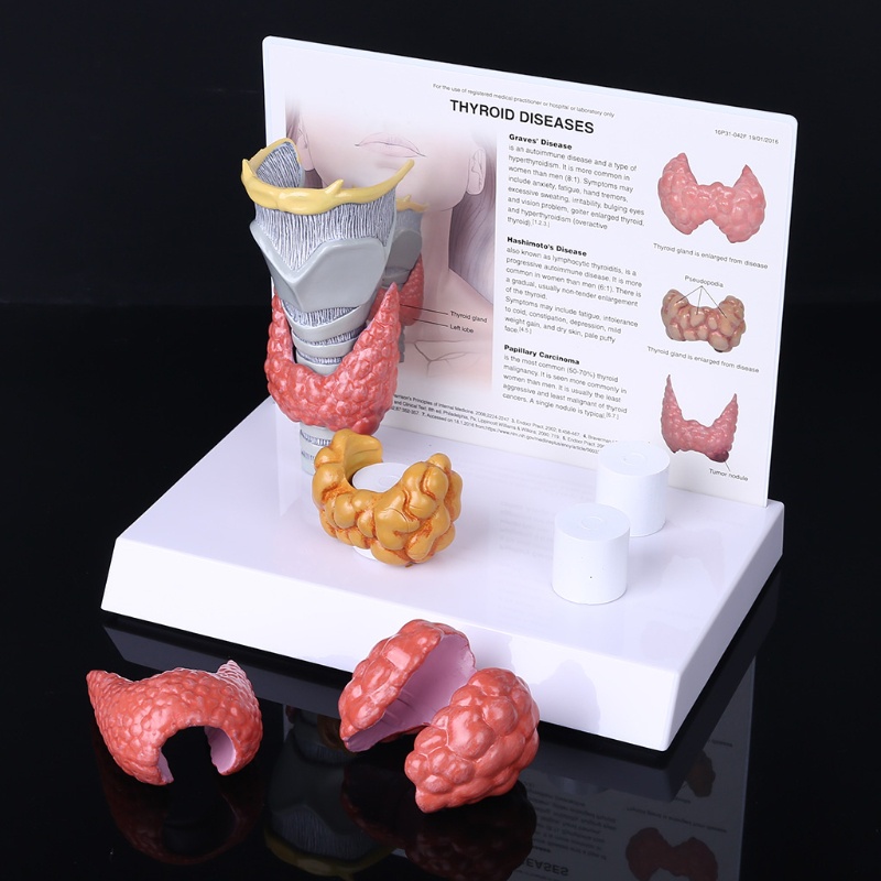 love* Human Anatomical Thyroid Gland Model Pathology Anatomy Digestive ...