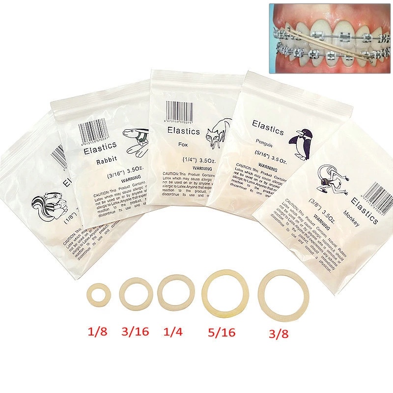1000pc Orthodontic Rubber Bands – Latex Elastics 3.5oz – Dental Braces Bands For Orthodontics