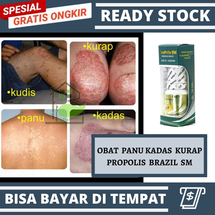 Medicine Panu, Lizards, Ringworm, Chicken Pox, Eczema, psoriasis ...
