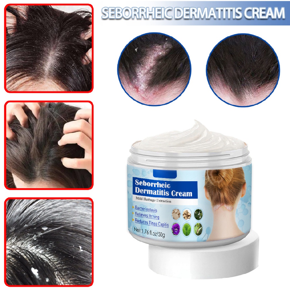 Seborrheic Dermatitis Cream Scalp Treatment Psoriasis Folliculitis Scalp Tinea Dandruff 1829