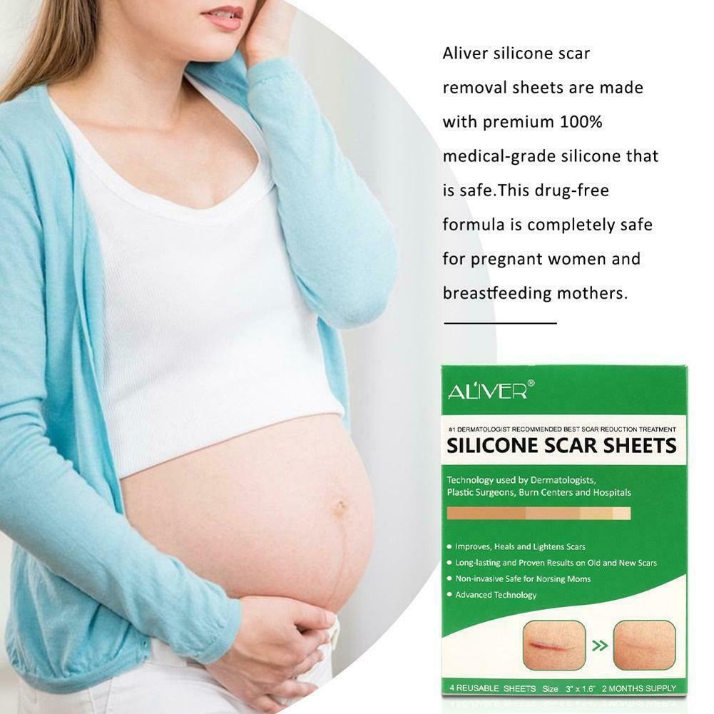 ALIVER / ELAIMEI Silicone Scar Sheets 4 Sheets Per Pack Silicone Scar ...