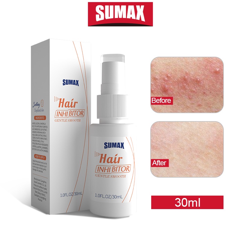 Sumax Hair Inhibitor Spray 30ml for Men Women Arms Legs Underarms ...