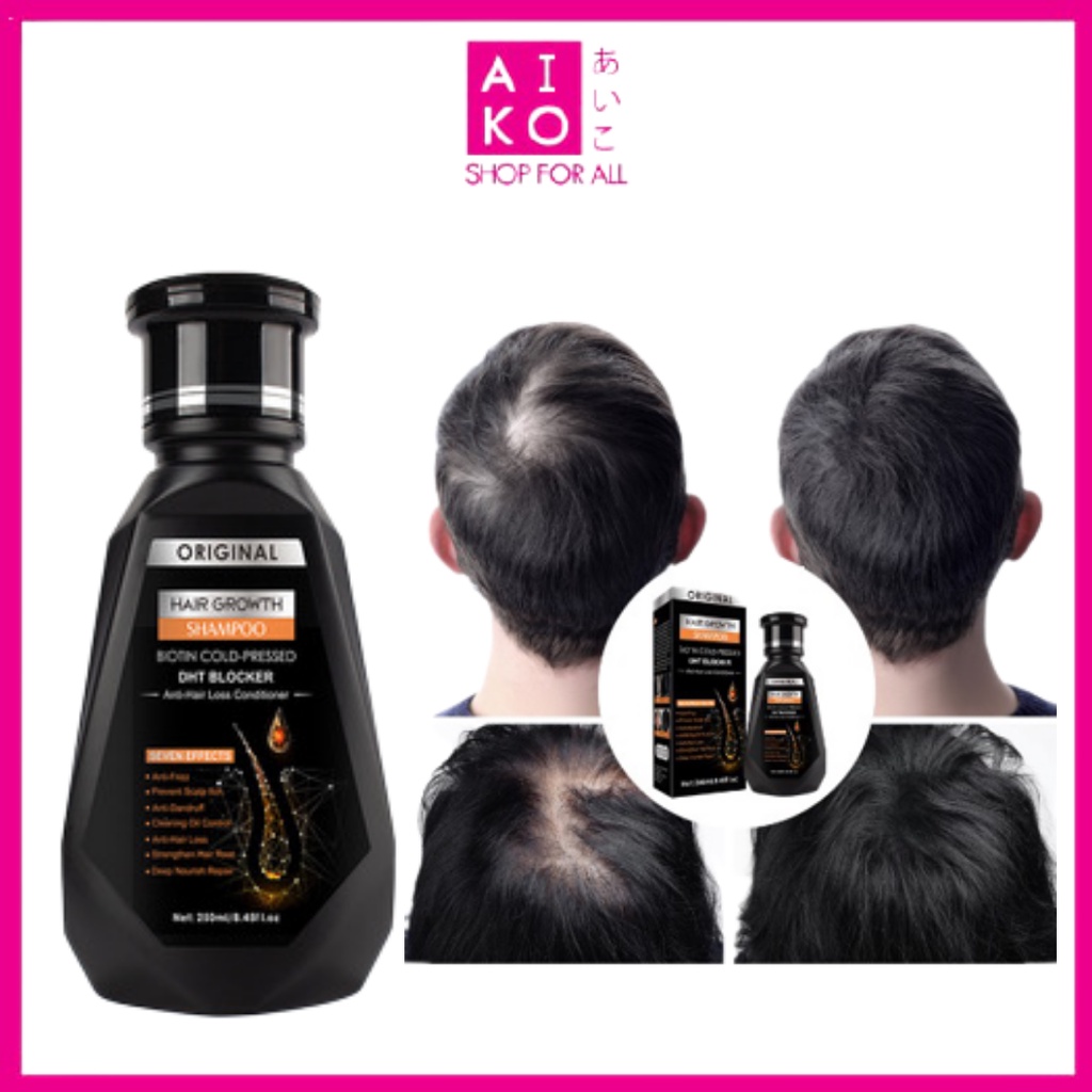 (AIKO)PEI MEI DHT BLOCKER ANTI HAIR LOSS HAIR GROWTH SHAMPOO 250ML ...