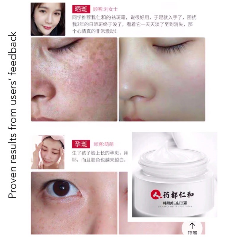 Whitening Pigmentation Freckle Cream & Nicotinamide Solution for Acne ...