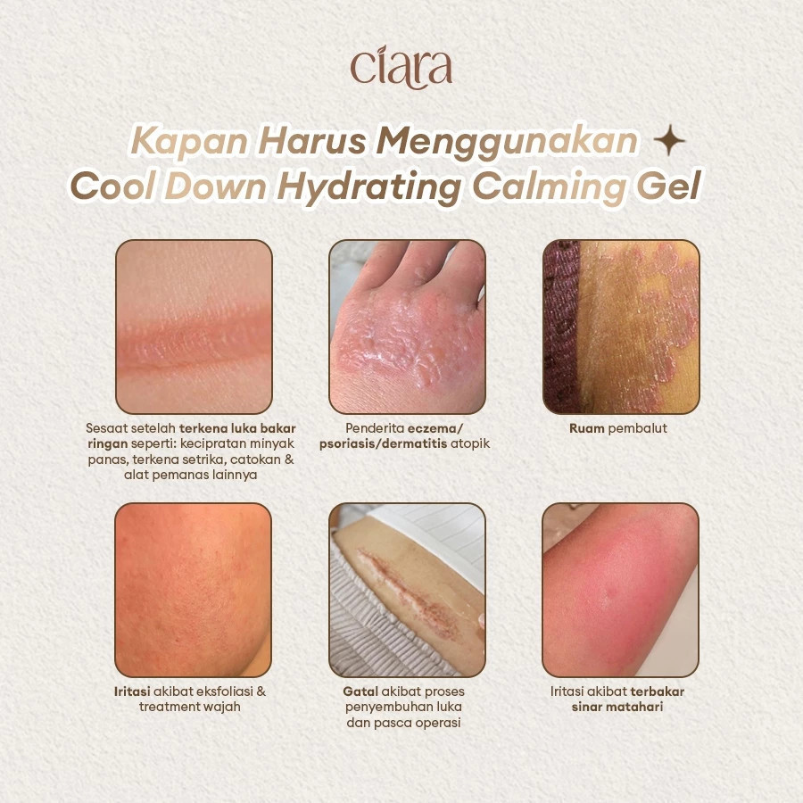 Ciara Cool Down Hydrating Calming Gel X Ciara Chamomile Calming / Membantu menyamarkan tampilan bekas luka pada kulit / Membantu menjaga kelembapan & hidrasi kulit / Membantu mengurangi rasa tidak nyaman pada kulitt - Gambar 4