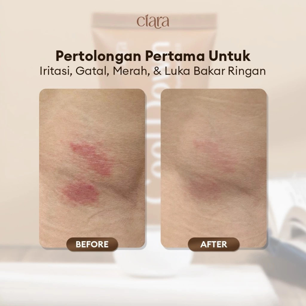 Ciara Cool Down Hydrating Calming Gel X Ciara Avocado Calming Liquid Wash X Chamomile Calming Cream / Membantu menyamarkan tampilan bekas luka pada kulit / Membantu menjaga kelembapan & hidrasi kulit / Membantu mengurangi rasa tidak nyaman pada kulit - Gambar 3