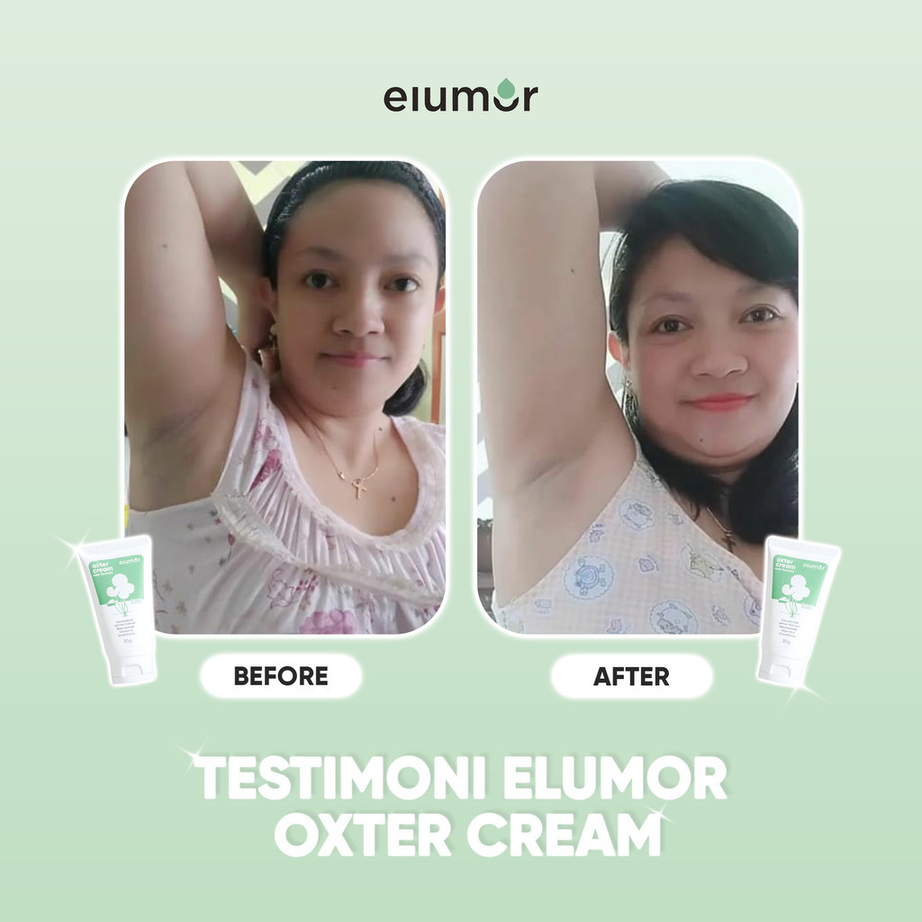 Elumor Oxter Cream New Formula 30g Underarm and Groin Whitening Cream ...