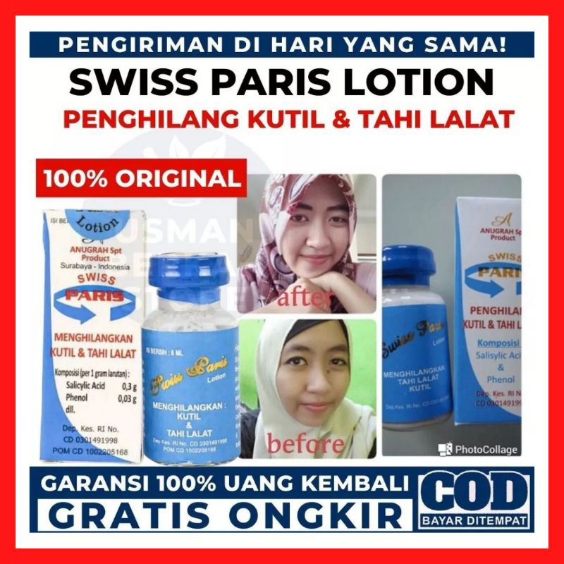 Swiss paris lotion Wart And Mole Removal Medicine On The Face And Body Permanent Wart Remover On