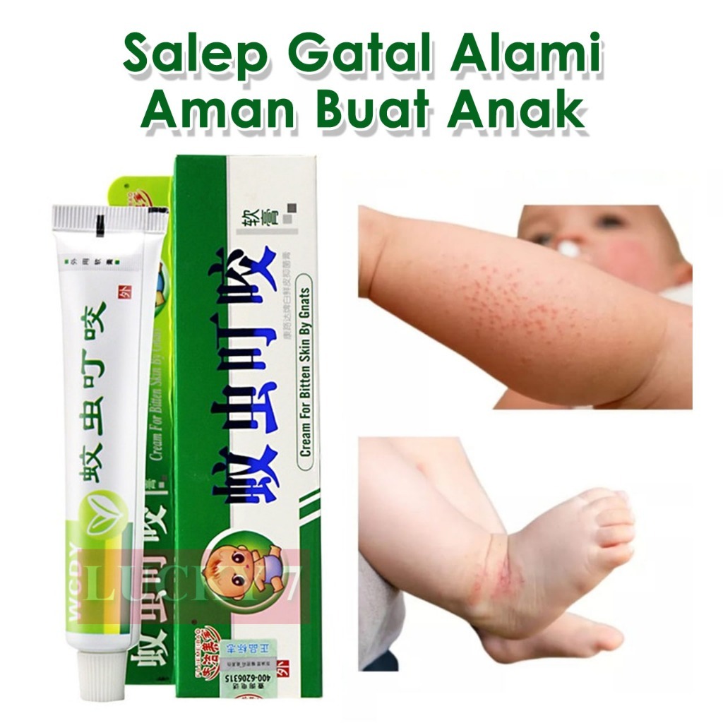 Medicine Ointment Itching Rash Allergy Children Baby Toddler Original