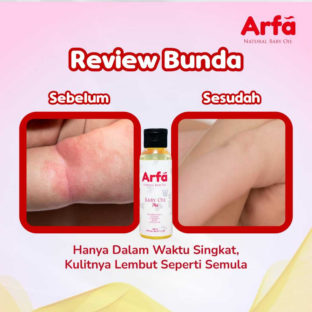 ARFA BABY OIL Minyak Telon Alami Cegah Kulit Iritasi - 3 Botol - Gambar 2