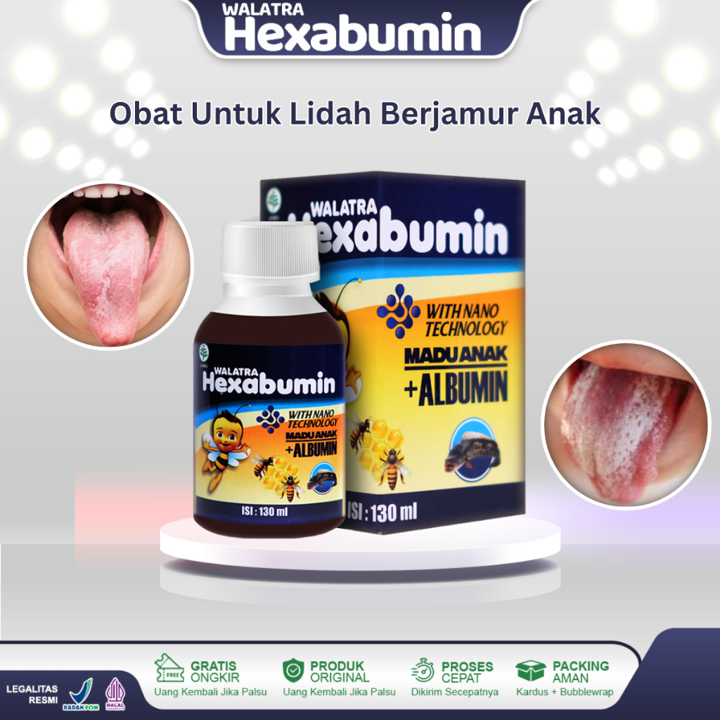 PUTIH Children's Tongue Fungus Medicine Candidiasis Numb Tongue Infection Candida Albicans