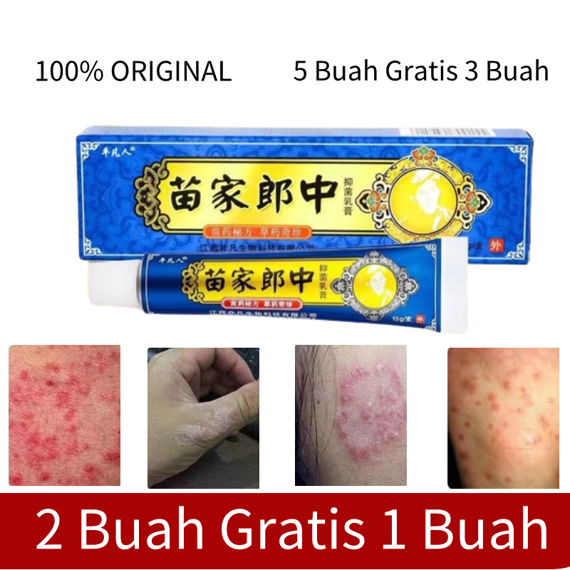The Most Powerful Itching Ointment Psoriasis Medicine For Scalp Itching