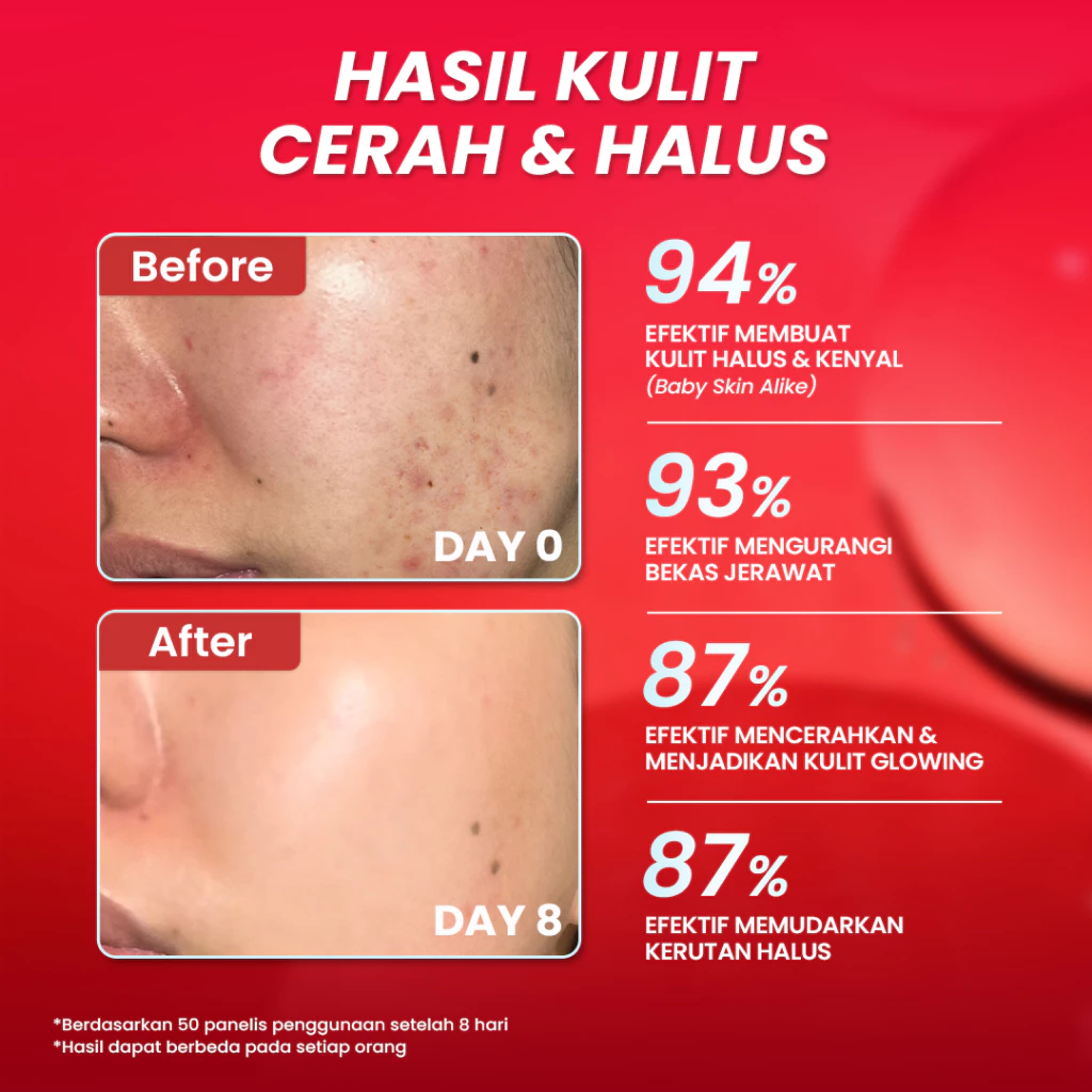 Hanasui Advance Retinol Serum - Anti Aging Serum untuk Kerutan Halus Tekstur Kulit Cerah Kenyal Encapsulated Retinol, HPR, Advance Niacinamide, 5X Ceramide - Gambar 2