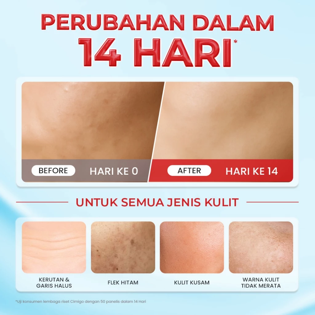 Hanasui Gentle Retinol Moisturizer Gel 30g - Pelembab Gel Lembap & Cegah Tanda Penuaan Dini - 3 Retinol Complex - Encapsulated Retinol & HPR - Gambar 4