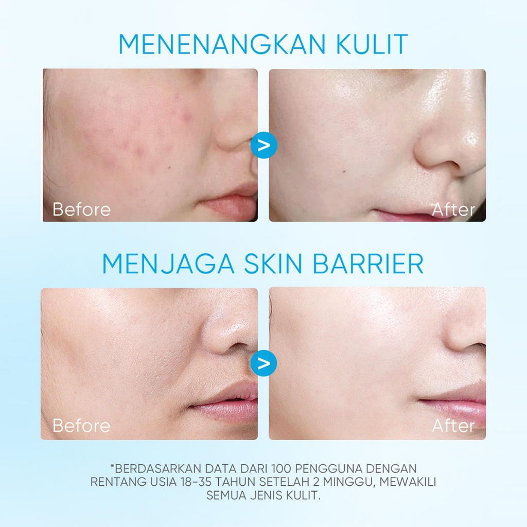 Skintific 5X Ceramide Soothing Toner 80ml - Gambar 3