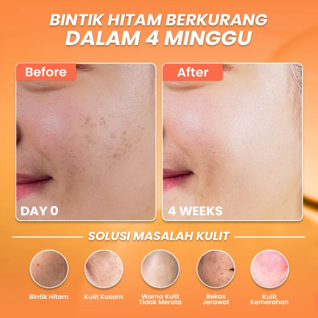 [5pcs Hemat] Hanasui Serum Vitamin C - Mencerahkan & Pudarkan Bintik Hitam 2% Vitamin C 2% Niacinamide 1% Betaine - Gambar 2