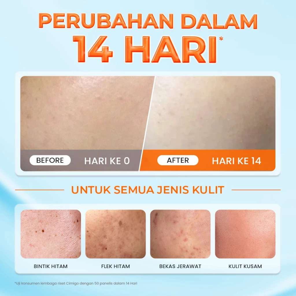 Hanasui Bright Expert Moisturizer Gel 30g - Pelembab Gel Bening Lembap & Mencerahkan - 5% Advance Niacinamide & Tranexamic Acid - Ratakan warna kulit & Kurangi Bintik Hitam - Gambar 4
