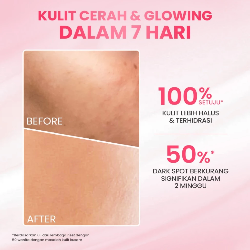 [Special Package] Hanasui Double Expert, Glow Better Set 4 pcs + Power Bright Expert Serum - Real 10% Advance Nianicinamide Menyamarkan Bintik Hitam Bekas Jerawat New Improved Formula - Gambar 3
