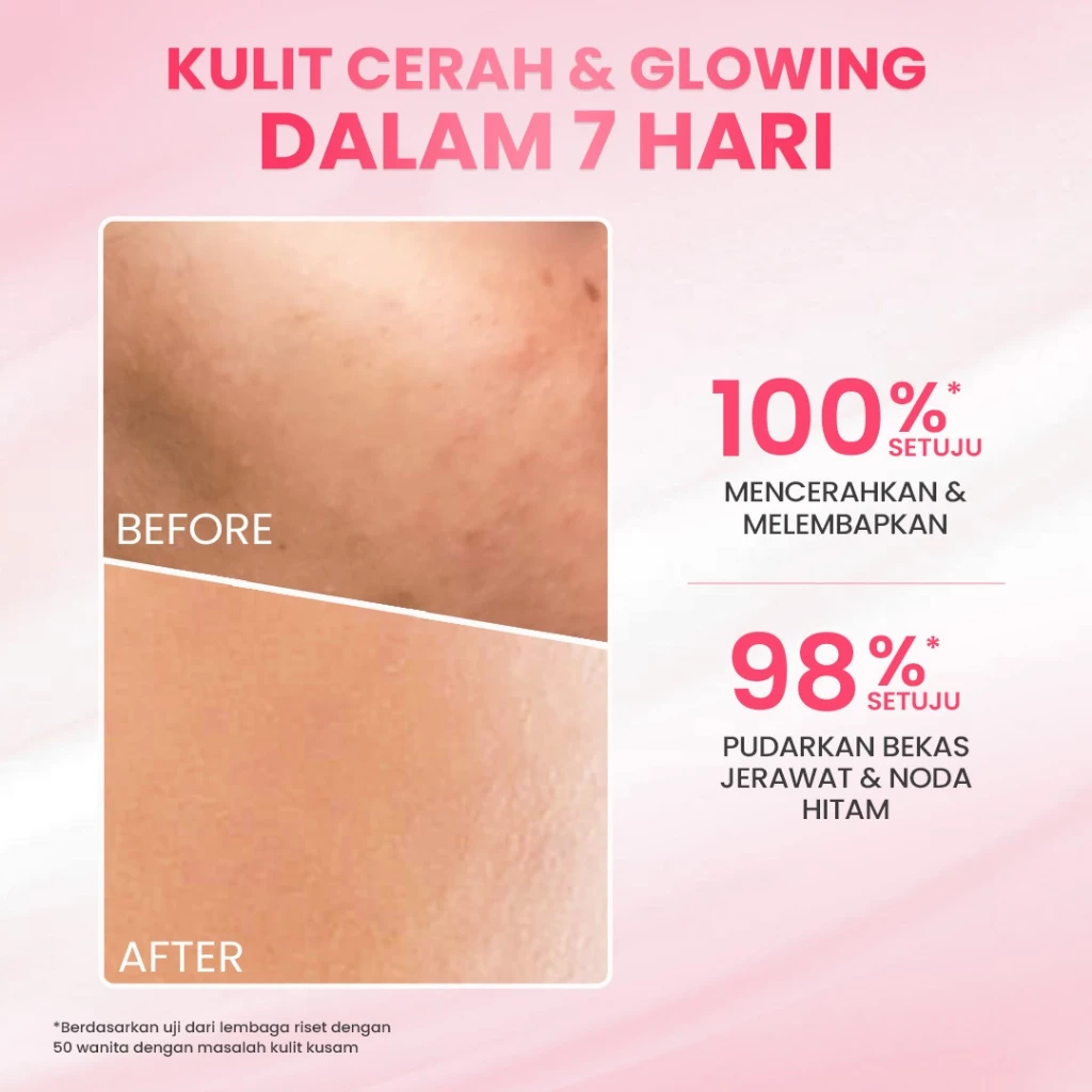 Hanasui Glow Expert Toner Essence New Improved Formula - Hidrasi Maksimal Mencerahkan & Menghaluskan - Niacinamide & Genowhite - Gambar 3