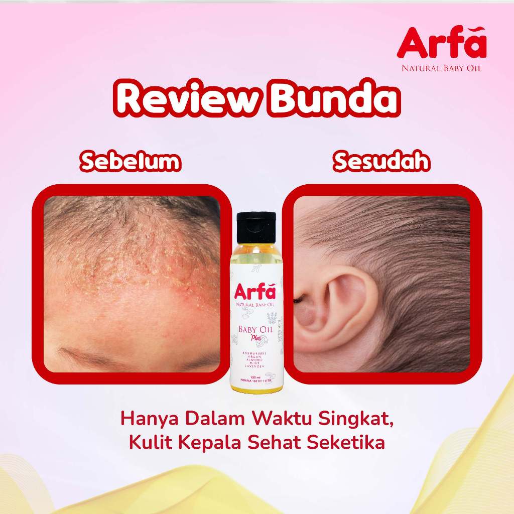 ARFA BABY OIL Minyak Telon Alami Cegah Kulit Iritasi - 3 Botol - Gambar 3