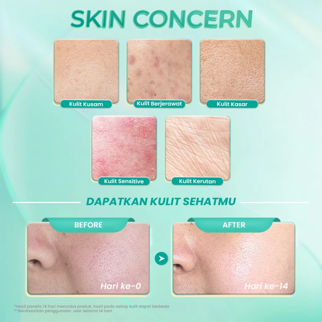 Hanasui Ceramide Probiotics Peeling Gel - Eksfoliasi Gel Wajah Perbaiki Skin Barrier Mencerahkan dan Angkat Sel Kulit Mati Komedo - Gambar 3
